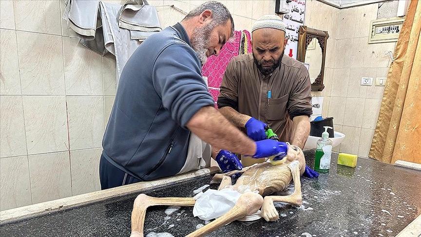 6 yaşındaki Filistinli Hikmet yetersiz beslenmeden hayatını kaybetti